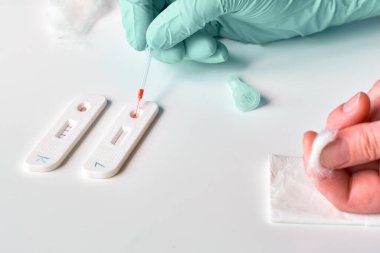 İgm ve IgG 'nin Corona virüsü SARS-CoV-2, Covid-19' a özel antikorların tespiti için hızlı COVID-19 testi. Kanı durdurmak için pamuklu sabır. Testte eldivenli hemşire eli pipette kanı vardı..