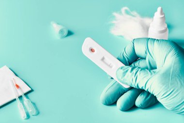 IgM ve IgG antikorları için hızlı COVID-19 antikor testi. Coronavirus SARS-CoV-2, Covid-19 viral zatürree. Eldivenli sıhhiyeciler testi durdurur. Canlı yeşil nane rengi.