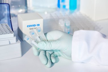 Rapid test system for novel COVID-19 coronavirus. 2019 nCoV pcr diagnostics kit. The kit detects covid19 virus in patients samples. esting system for real-time PCR amplification. clipart