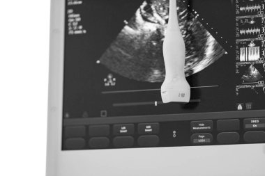 Bir ultrason cihazı bir resim ve monitör düzeyinde asılı bir sensör ile kontrol ediniz. Siyah beyaz resim.