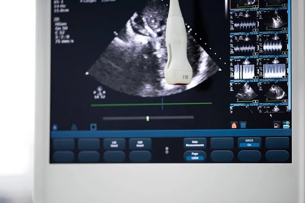 Ultrasound Monitor Picture Sensor Hangs Monitor Level — Stock Photo, Image