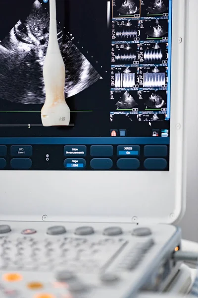 The ultrasound monitor with a picture and a sensor that hangs at the monitor level