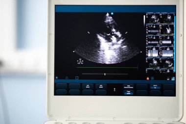 Ultrason cihaz ekran görüntü ile kalp kesim, sol ventrikül çıkım yolu ölçülü.