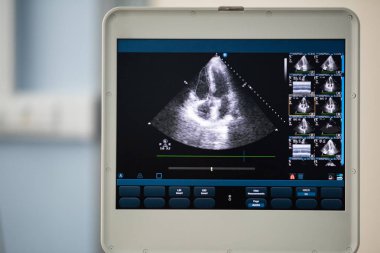 Ultrason cihaz ekran gösterir bir tarama kalp bir dört-odası konumda ve sağ ventrikül boşluğuna bir noktalı çizgi ile çevrilidir.