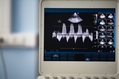 Ultrason cihaz ekran görüntüsüyle basınç gradyan ölçüm 