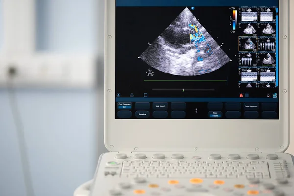 Bildschirm Eines Ultraschallgerätes Mit Einem Herzscan Mit Der Doppler Methode — Stockfoto