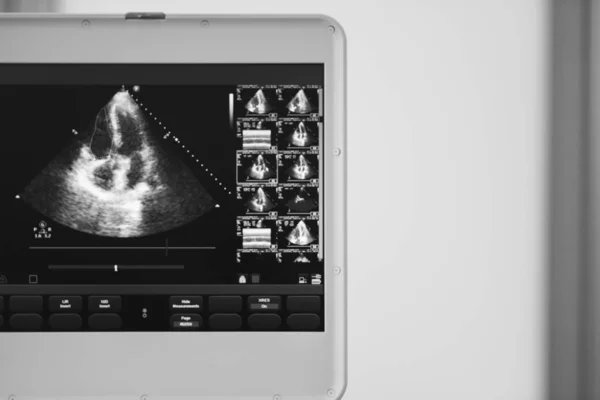 Screen Ultrasound Device Shows Scan Heart Four Chamber Position Cavity — Stock Photo, Image