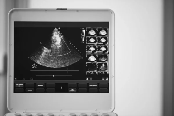 Auf Dem Bildschirm Des Ultraschallgeräts Ein Herzscan Vier Kammer Position — Stockfoto