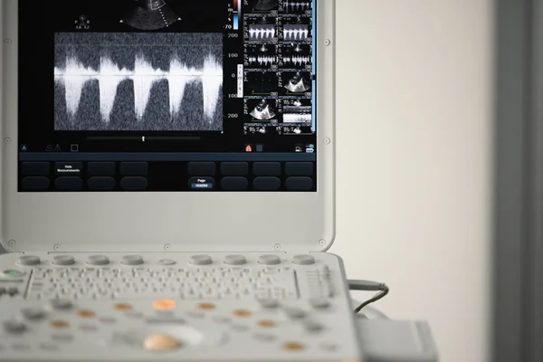 Screen Ultrasound Machine Image Right Ventricular Outflow Tract Established Control — Stock Photo, Image