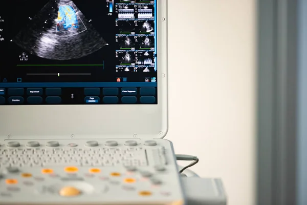 心臓検査の後現代超音波スキャナーのキーボード コントロール パネル画面 — ストック写真