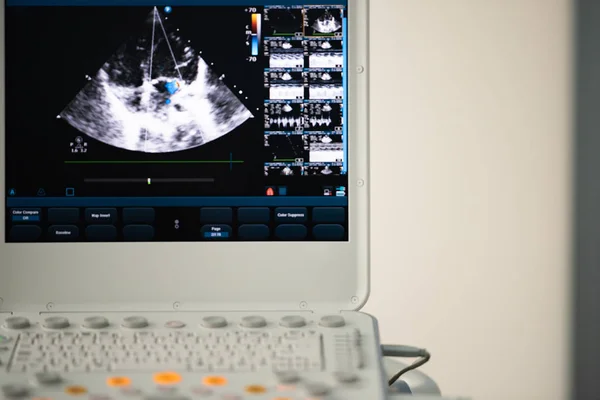 Screen Ultrasound Scanner Image Heart Four Chamber Position Marked Blue — Stock Photo, Image