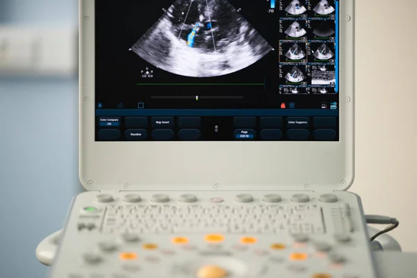 Screen Ultrasound Scanner Heart Image Four Chamber Position Marked Blue — Stock Photo, Image