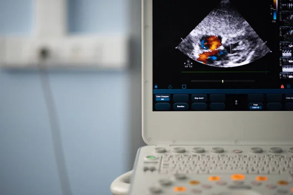 Auf Dem Bildschirm Eines Modernen Ultraschallscanners Einem Herzbild Mit Einem — Stockfoto