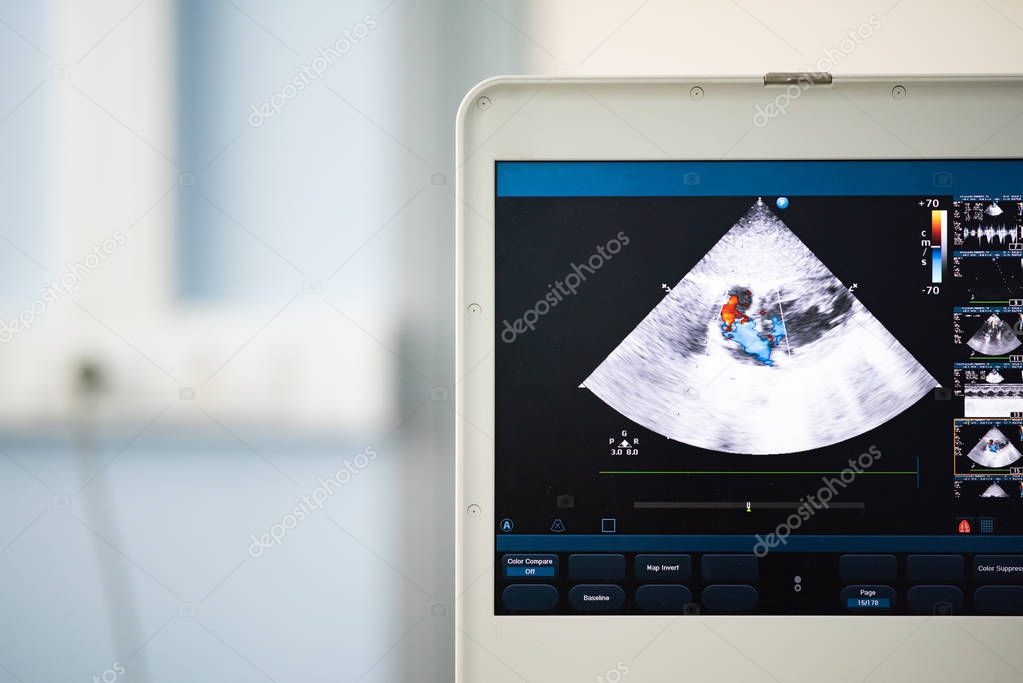 En la pantalla de un moderno escáner de ultrasonido, una imagen de las ...
