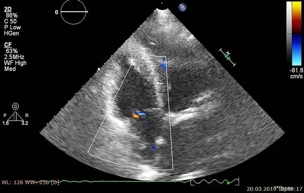 Écran de la machine d'échocardiographie (échographie) . — Photo