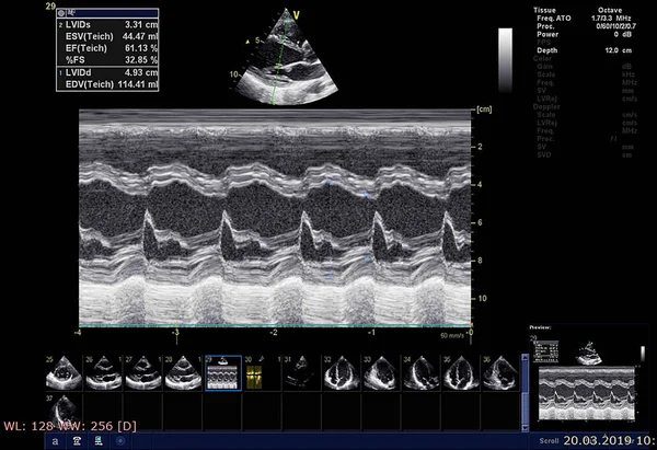 Scherm van echocardiografie (echografie) machine. — Stockfoto