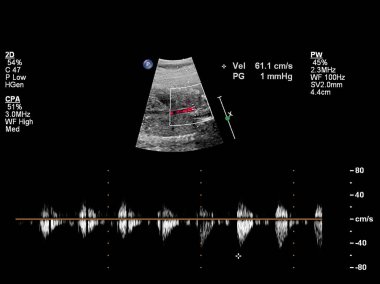 Fetal kalbin ultrason muayenesi.
