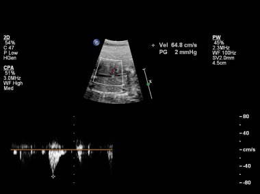 Fetal kalbin ultrason muayenesi.