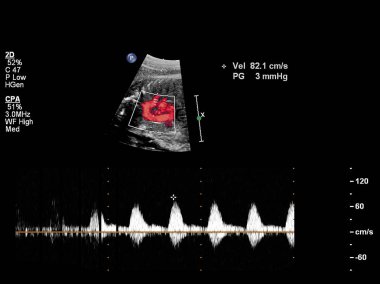 Fetal kalbin ultrason muayenesi.