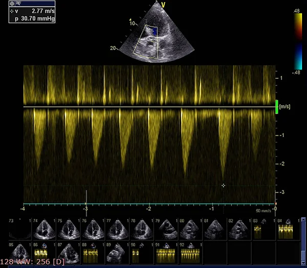 Scherm van echocardiografie (echografie) machine. — Stockfoto