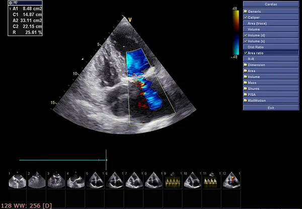 Ekokardiyografi (ultrason) makinesi nin ekranı. — Stok fotoğraf