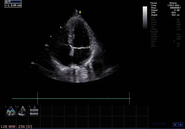 Pantalla de la máquina de ecocardiografía (ultrasonido) . — Foto de Stock