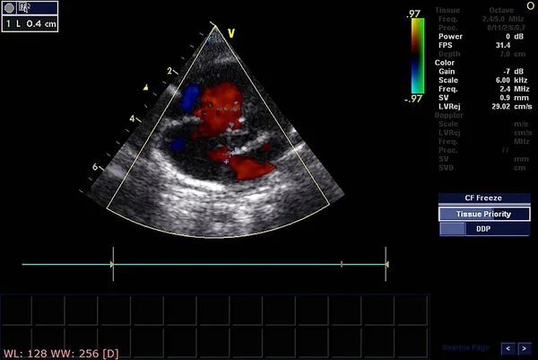 超声心动图（超声）机屏幕. — 图库照片