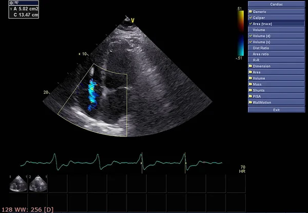 Écran de la machine d'échocardiographie (échographie) . — Photo