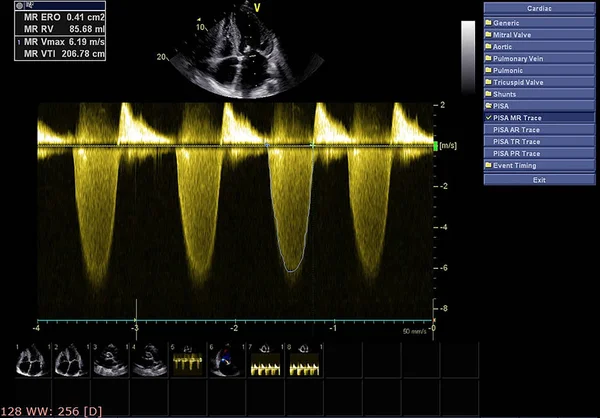 Ekran echokardiografii (USG) maszyny. — Zdjęcie stockowe