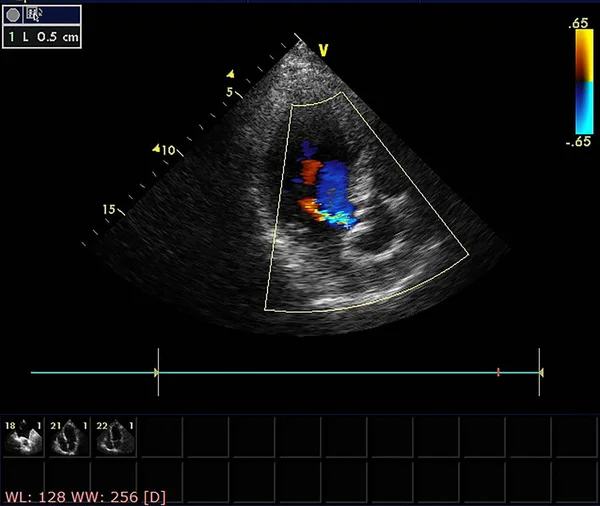 Écran de la machine d'échocardiographie (échographie) . — Photo