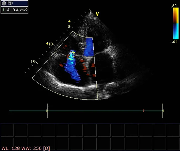 心エコー検査(超音波)マシンの画面. — ストック写真
