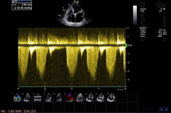 Scherm van echocardiografie (echografie) machine. — Stockfoto