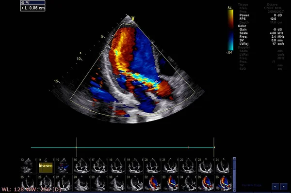 Pantalla de la máquina de ecocardiografía (ultrasonido) . —  Fotos de Stock