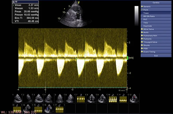 Bildschirm der Echokardiographie (Ultraschall) Maschine. — Stockfoto