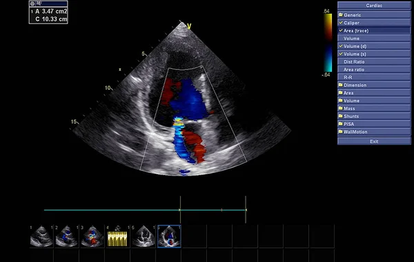 Ekokardiyografi (ultrason) makinesi nin ekranı. — Stok fotoğraf