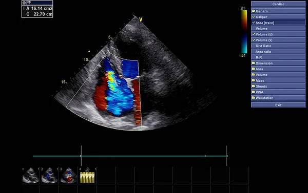 Écran de la machine d'échocardiographie (échographie) . — Photo