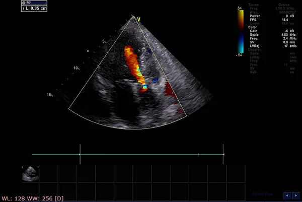 超声心动图（超声）机屏幕. — 图库照片