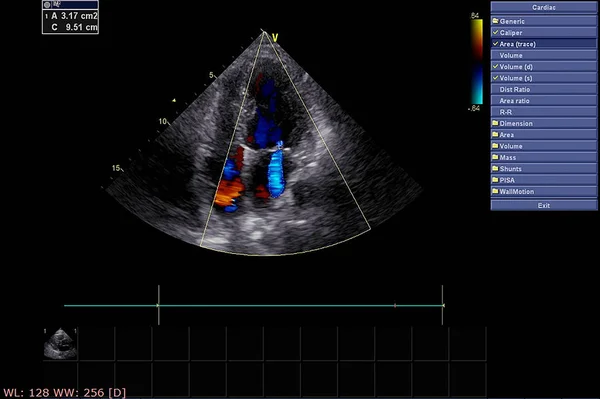 Экран эхокардиографической (ультразвуковой) машины . — стоковое фото