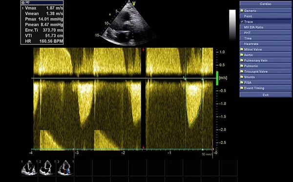 Scherm van echocardiografie (echografie) machine. — Stockfoto