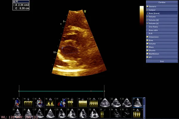 Ekokardiyografi (ultrason) makinesi nin ekranı. — Stok fotoğraf