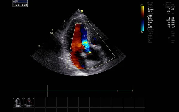 Tela da máquina de ecocardiografia (ultra-som) . — Fotografia de Stock