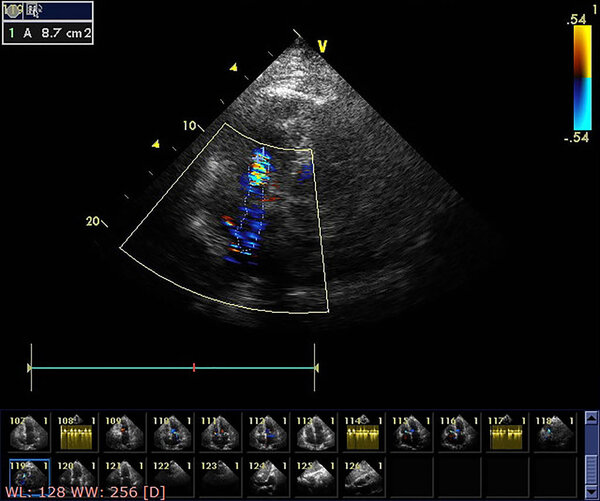 Экран эхокардиографической (ультразвуковой) машины
.