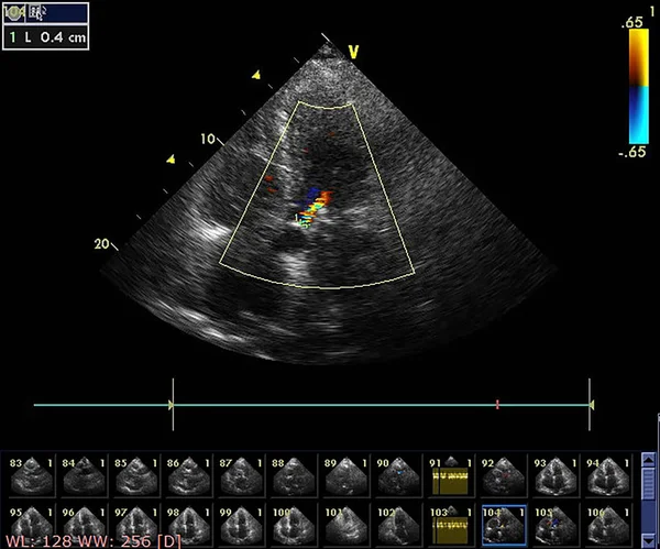 Mesin echocardiography (ultrasound) layar . — Stok Foto