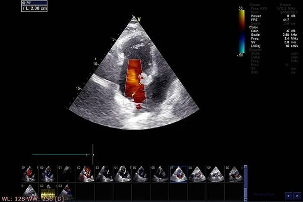 Tela da máquina de ecocardiografia (ultra-som) . — Fotografia de Stock