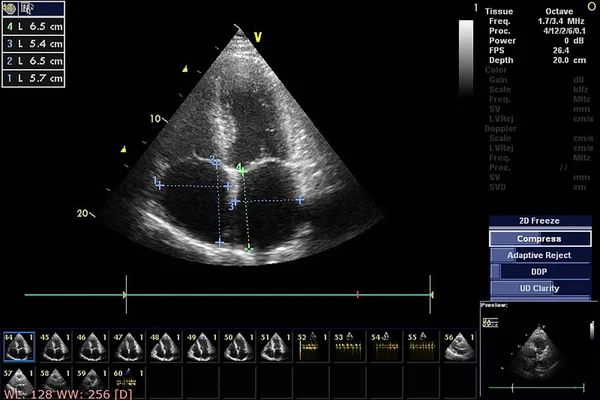 Ekokardiyografi (ultrason) makinesi nin ekranı. — Stok fotoğraf