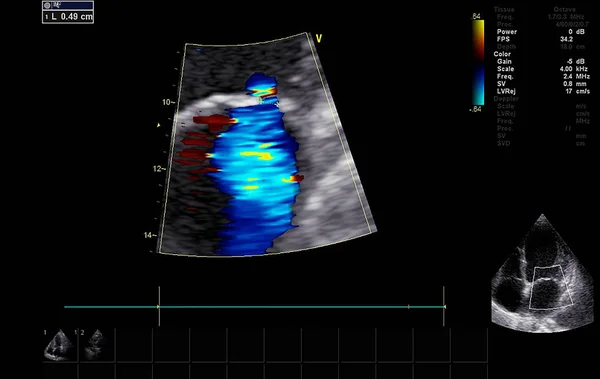 Scherm van echocardiografie (echografie) machine. — Stockfoto