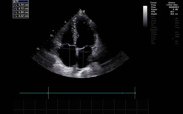 Écran de la machine d'échocardiographie (échographie) . — Photo