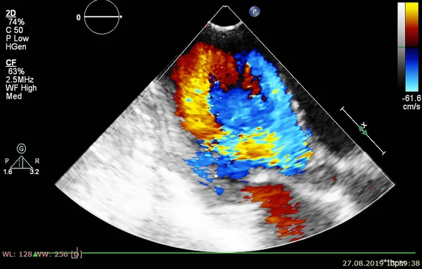 Οθόνη ηχοκαρδιογραφίας (υπερήχων) μηχανή. — Φωτογραφία Αρχείου