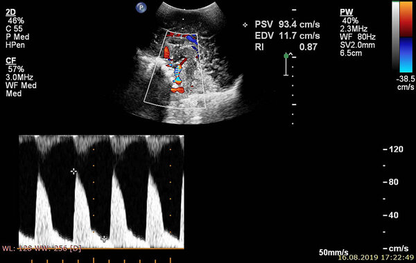 Экран эхокардиографической (ультразвуковой) машины
.