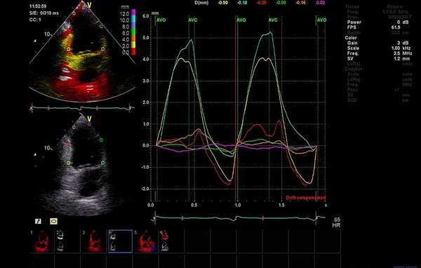 Scherm van echocardiografie (echografie) machine. — Stockfoto